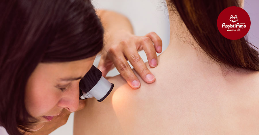 Il melanoma: sintomi, cause, come intervenire